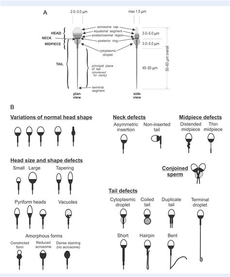 The functional anatomy of the human spermatozoon: relating ...